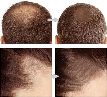 Hairline Powder